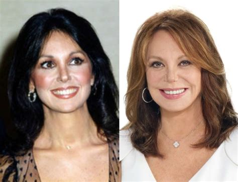 Did Marlo Thomas Have Plastic Surgery? Exploring the Facets of Celebrity Transformations