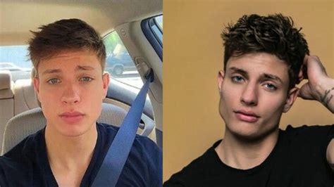 Did Matt Rife Get Plastic Surgery? Exploring the Rumors and Realities of Celebrity Transformations