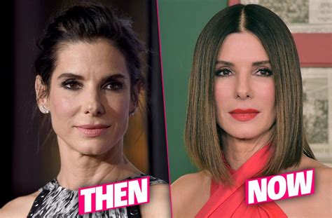 Has Sandra Bullock Had Plastic Surgery? Exploring the Rumors and Realities